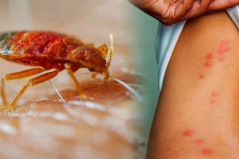 Najezda kućnih stjenica: sve češći problem i kako ga suzbiti